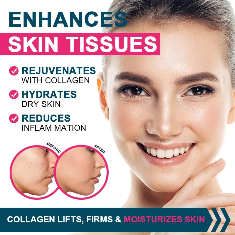 Goodbye Joint Pain - [Multiple Collagen Complex] in 7 days